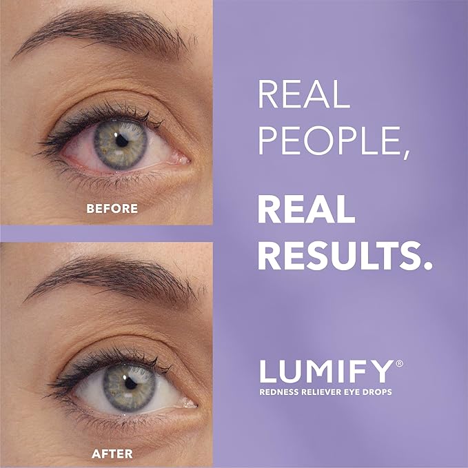 LUMIFY® Redness Reliever Eye Drops – 0.25 fl oz (7.5 mL)